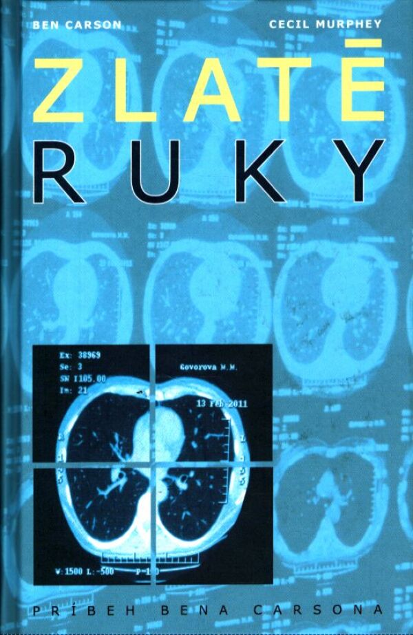 Ben Carson, Cecil Murphey: ZLATÉ RUKY